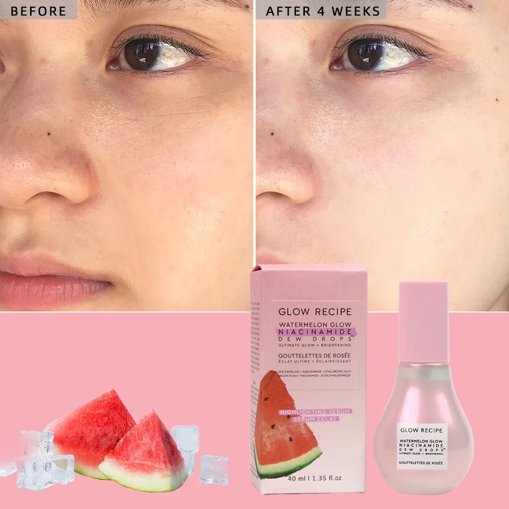 Glow recipe - sérum watermelon glow niacinamide dew drops - Rosalinaboutique