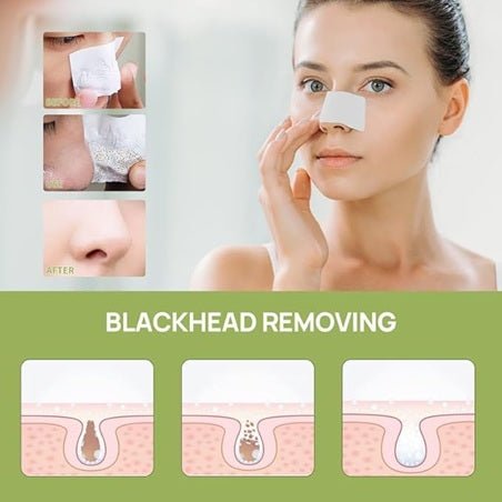 Lanbena - dissolvant de points noirs, bandes pour pores du nez pour points noirs - Rosalinaboutique